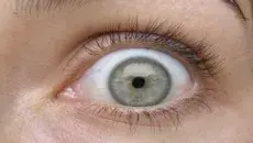 Massage Gun am Auge – ein gefährliches Experiment